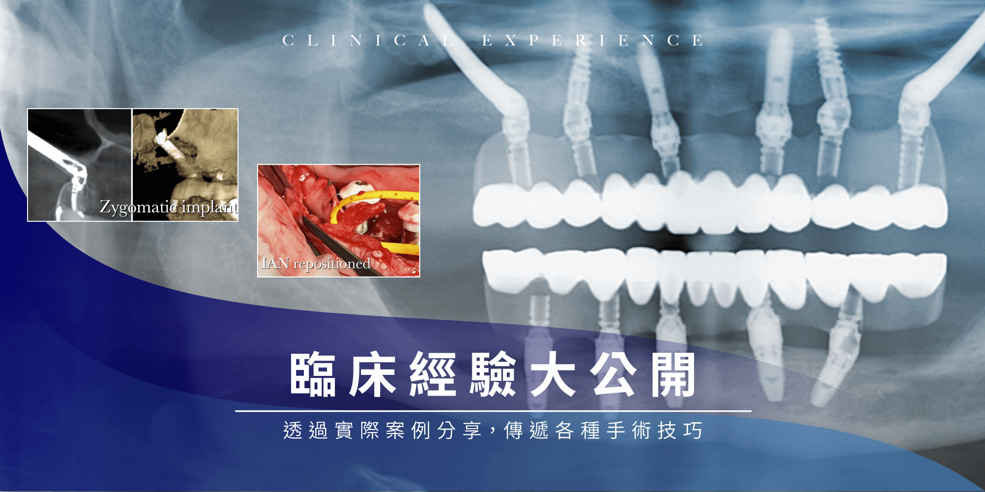 臨床經驗大公開-7